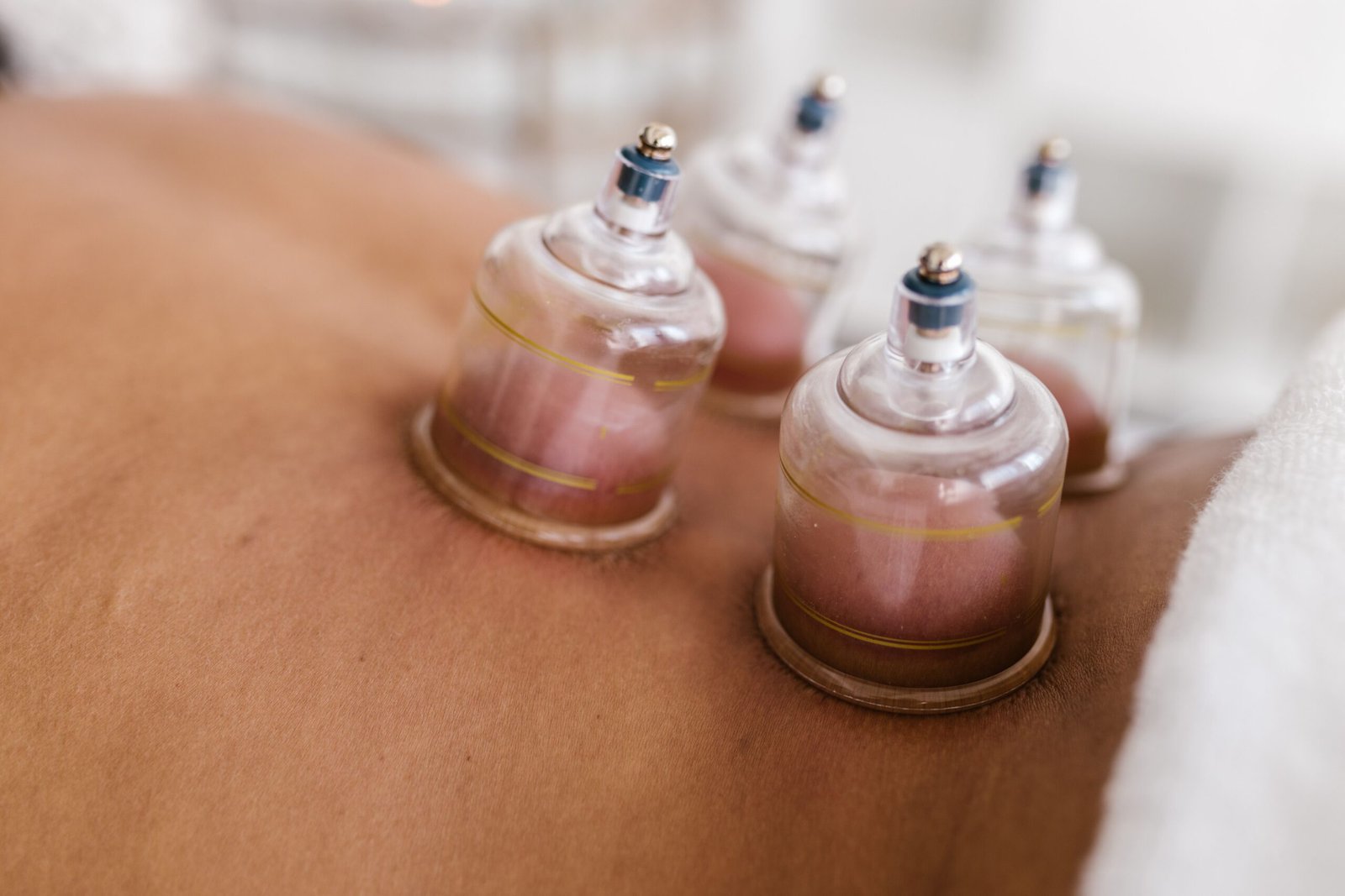 cupping cupping